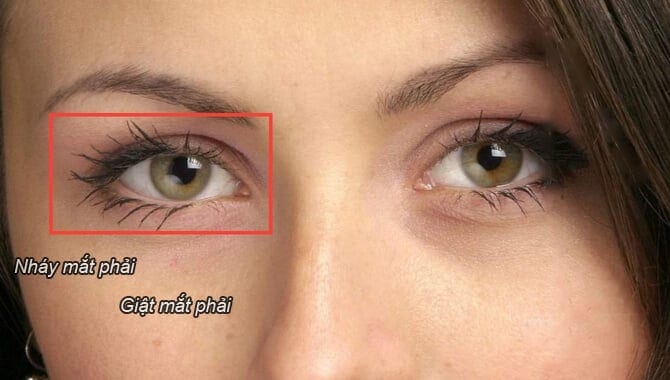 giật mắt phải